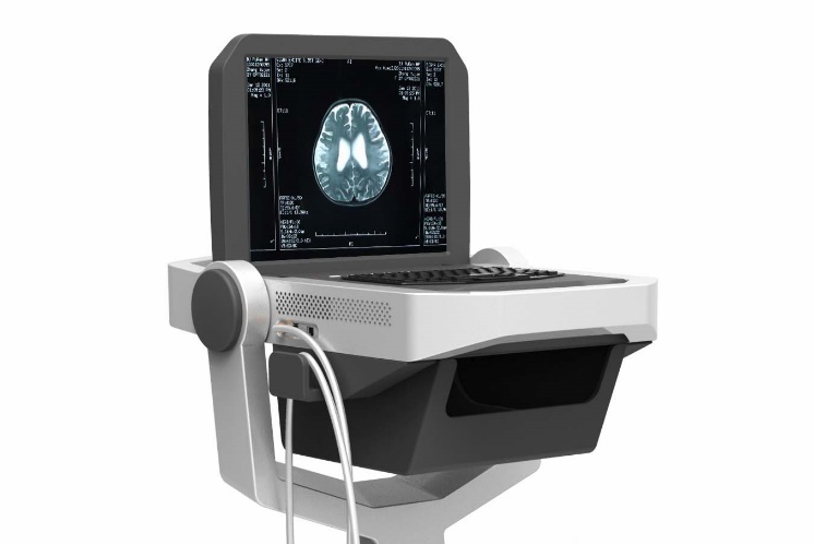 Hydrocephalus Detector