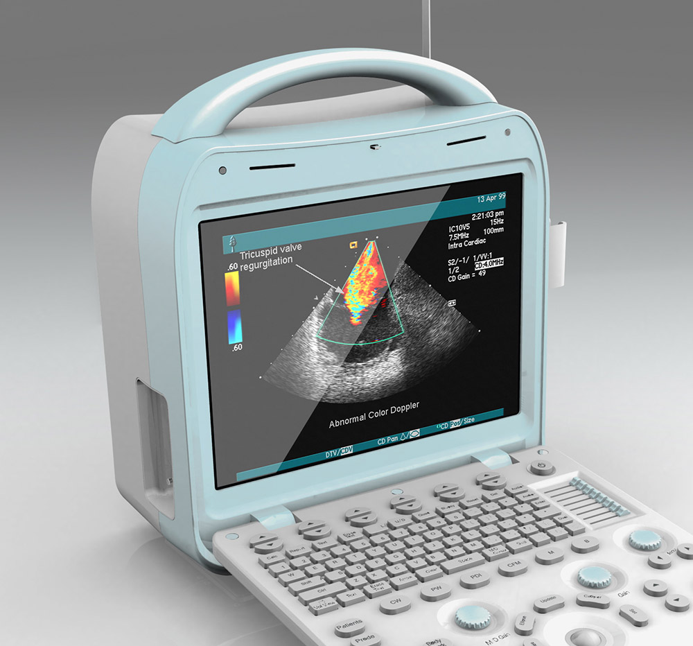 Portable Color Ultrasound Instrument